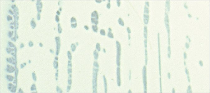 Image alt text